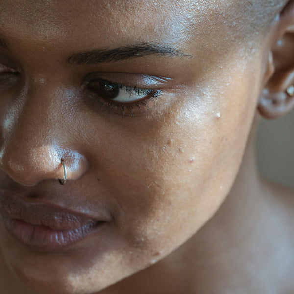 Barrier Culture: Why Your Skin Is Overwhelmed and How to Fix It