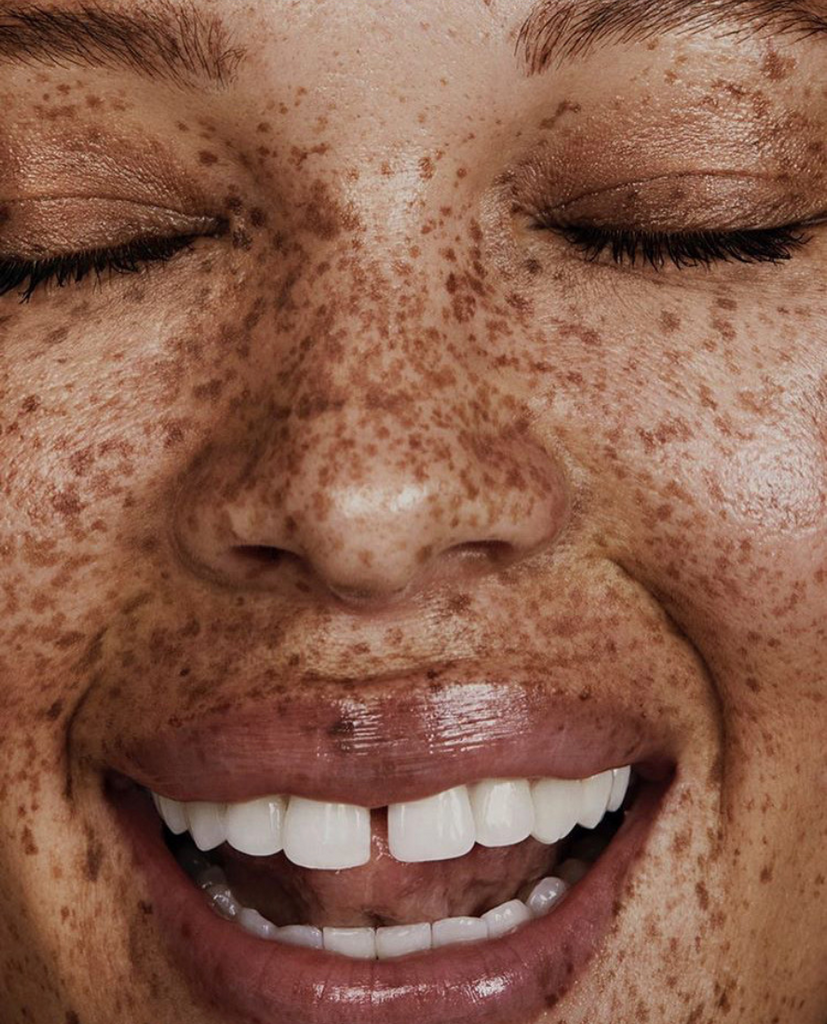 Skinfluencers: Feel More At Peace With The Skin You’re In