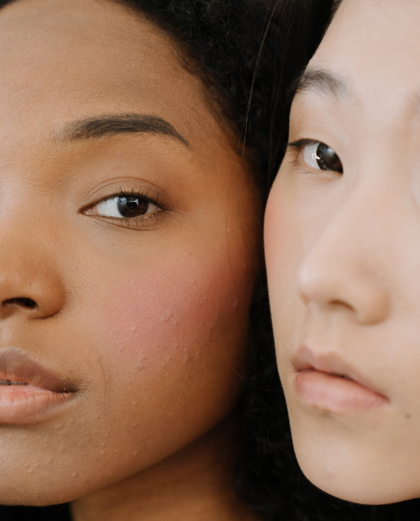 The Undeniable Connection Between Rosacea And Gut Health