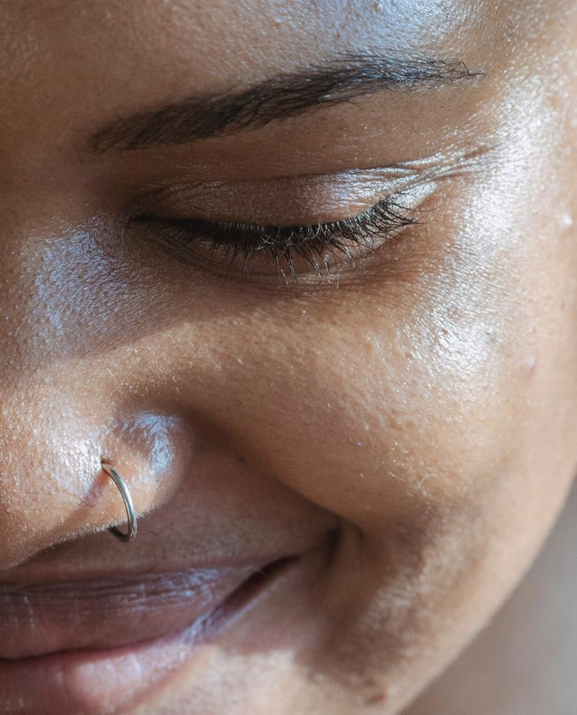 How To Manage Menopause Acne