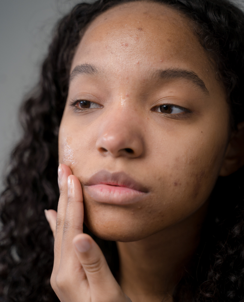 A Beginner’s Guide To Skincare Acids