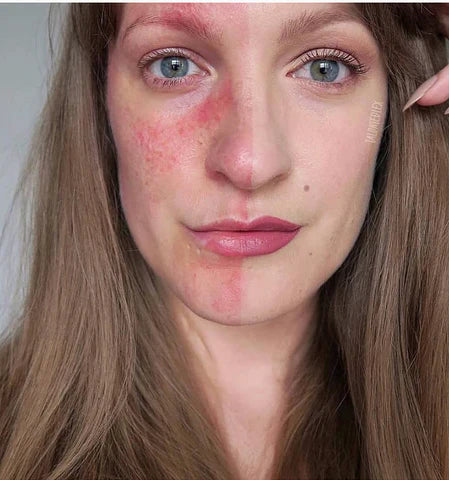 talontedlex-skinfluencers