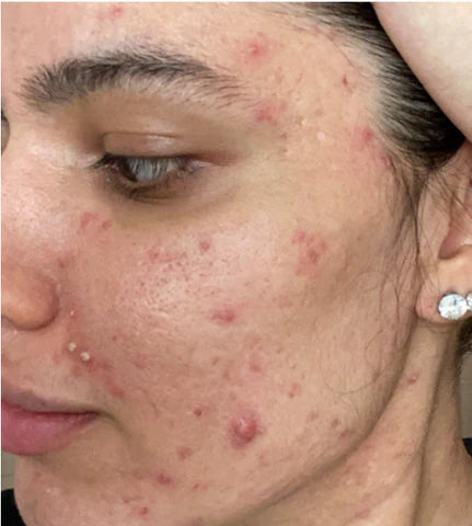 emeraldxbeauty-skinfluencers