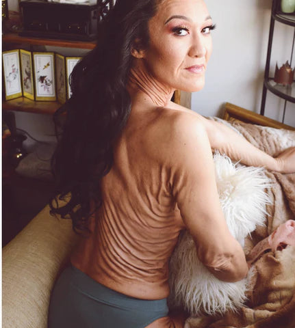 saraguerts-skinfluencers